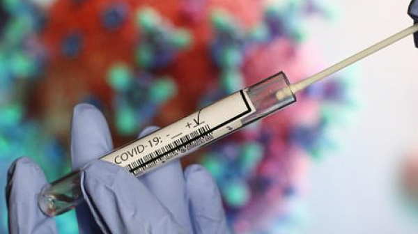 435 нови случаи на коронавирус у нас